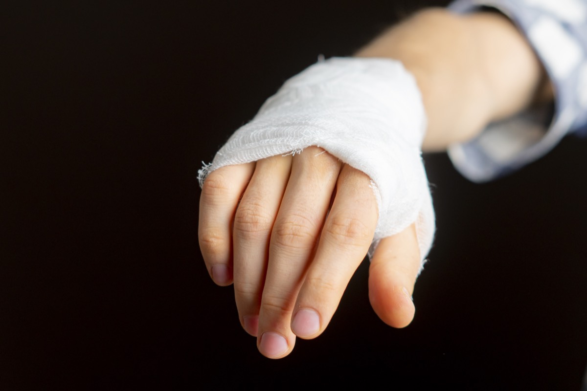Bandagierte Hand – die Folge fehlenden Handschutzes am Arbeitsplatz