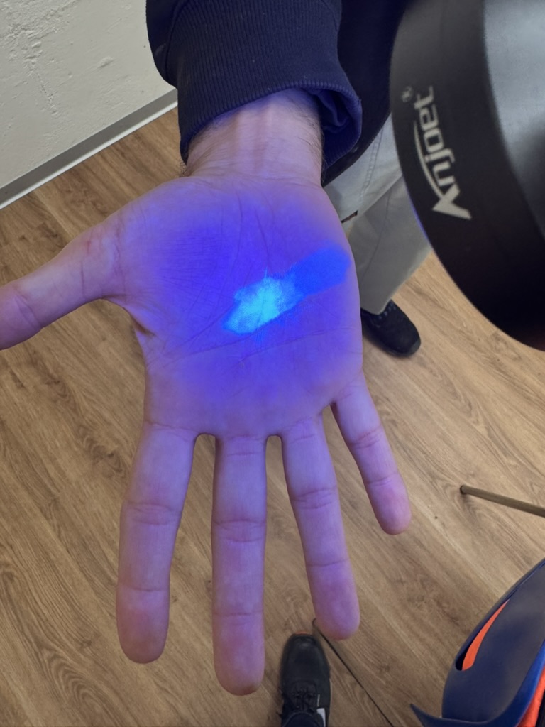 Handfläche unter UV-Licht mit sichtbaren Rückständen